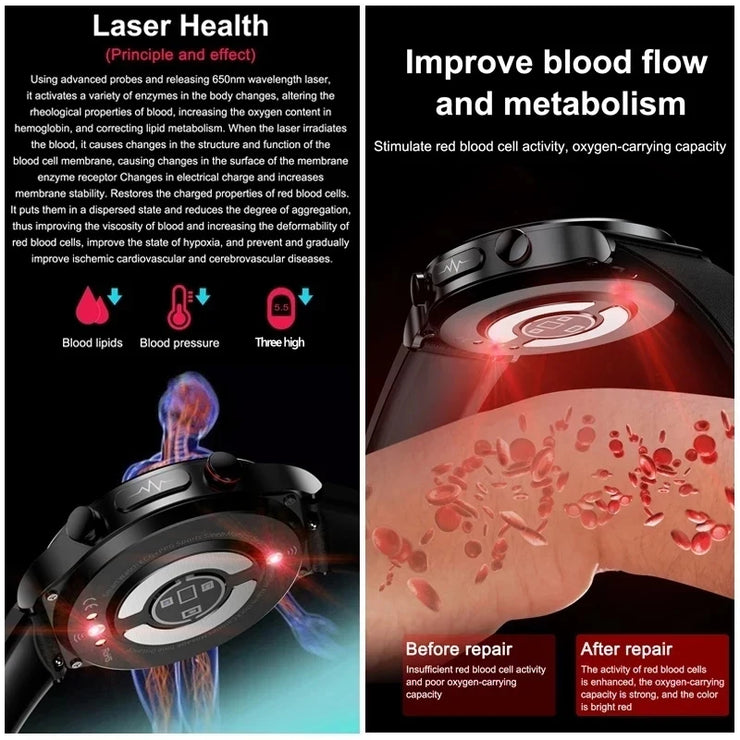 2025 New Laser Therapy ECG+PPG Smartwatch