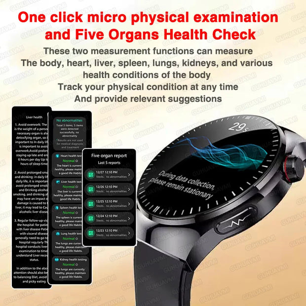 High-precision ECG Blood Lipids Risk Smart Watch